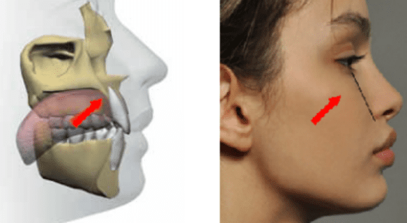 Mewing: the viral technique for jaw definition - HIGHXTAR.