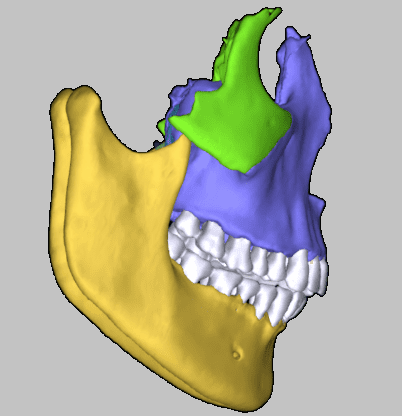 model of the maxilla and the mandibule