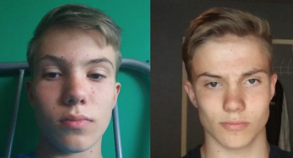 17M) 1 Year and 10 Month Mewing (No Chewing) (Same Weight) : r/Mewing